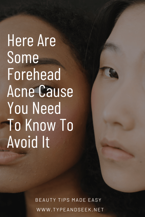 Here Are Some Forehead Acne Cause You Need To Know To Avoid It