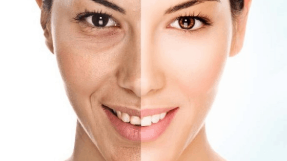 Here Are Some Best Beauty Tips For Face Pimples For Skin Glow