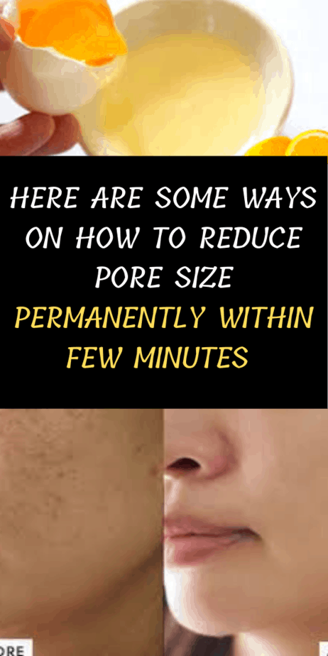 Here Are Some Ways On How To Reduce Pore Size Permanently Within Few Minutes