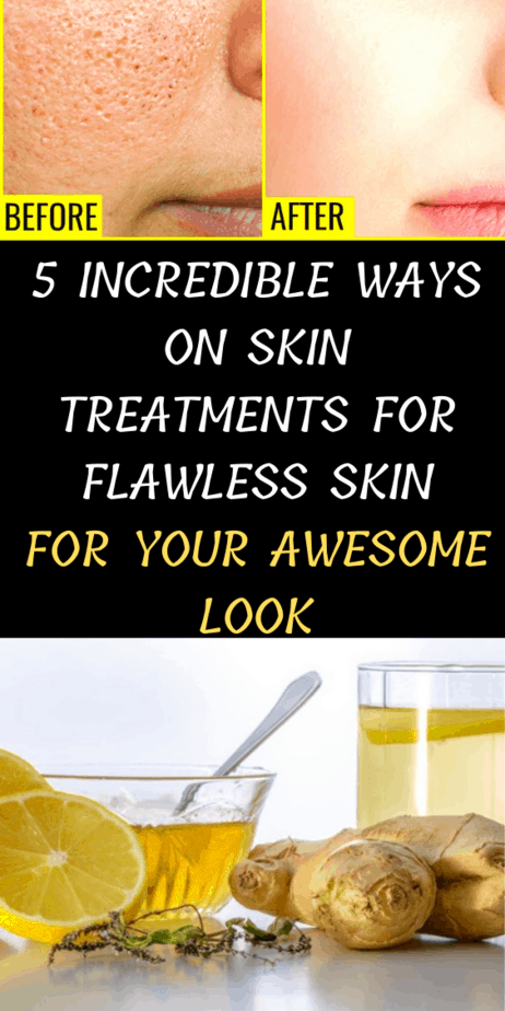 5 Incredible Ways On Skin Treatments For Flawless Skin For Your Awesome Look