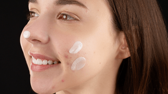 The Secret Of How To Remove Blackheads On Cheeks By Experts