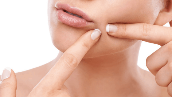 Best Ways On How To Get Rid Of Hard Whiteheads On Face