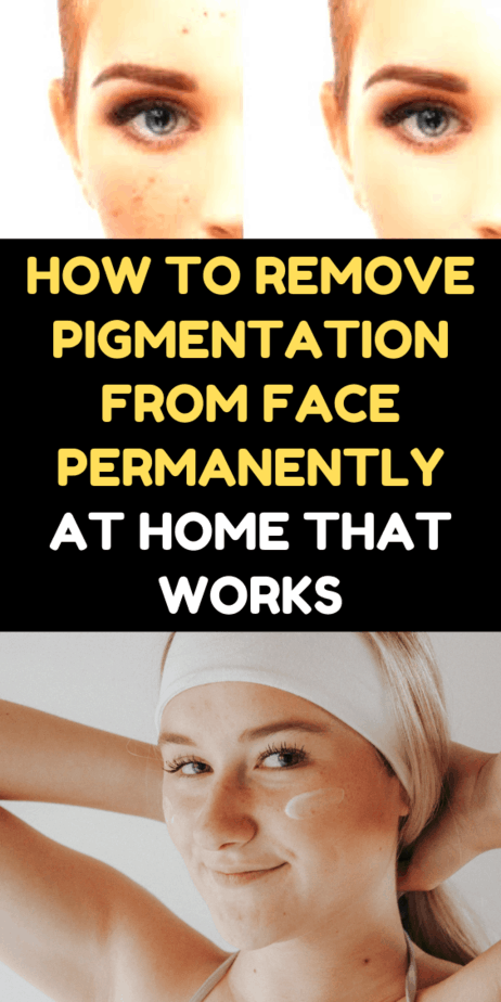 How To Remove Pigmentation From Face Permanently At Home That Works