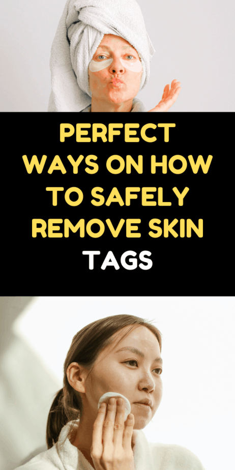 How To Safely Remove Skin Tags