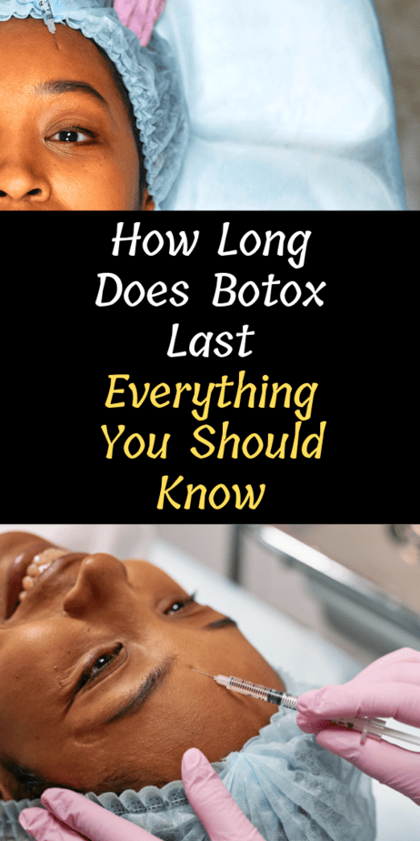 how-long-does-botox-last