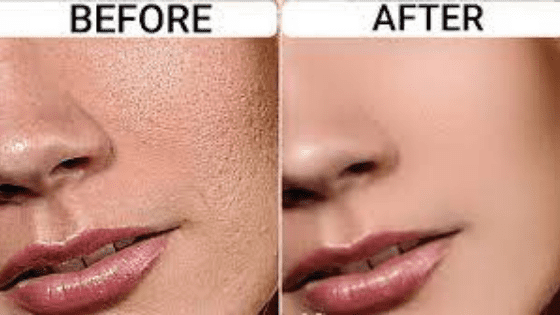 Best Ways On How To Smooth Skin Texture On Face By Experts