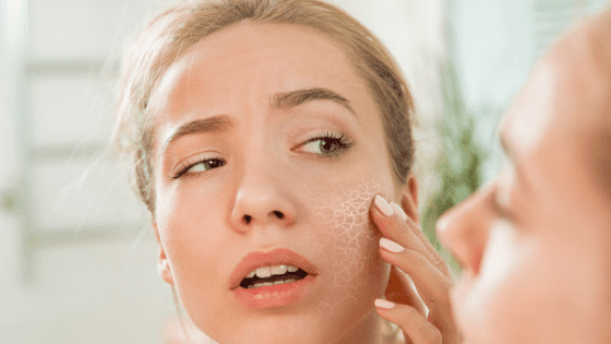 how-to-soothe-irritated-skin