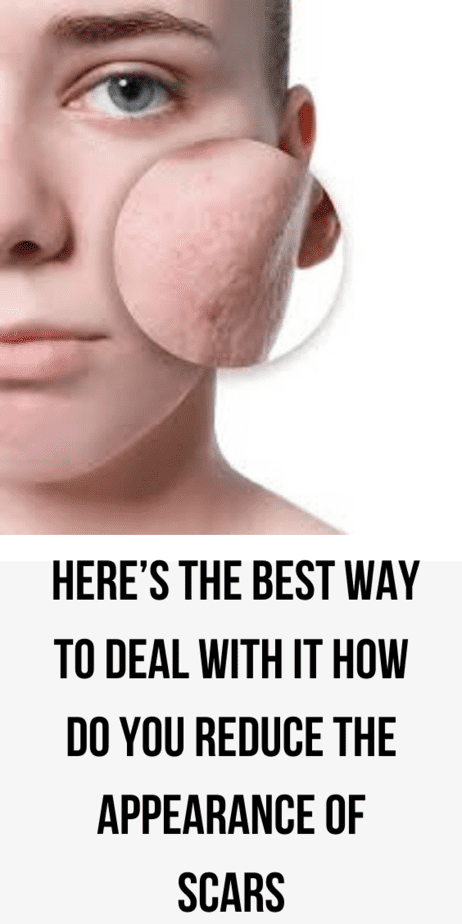 how-do-you-reduce-the-appearance-of-scars