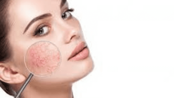 how-do-you-reduce-the-appearance-of-scars